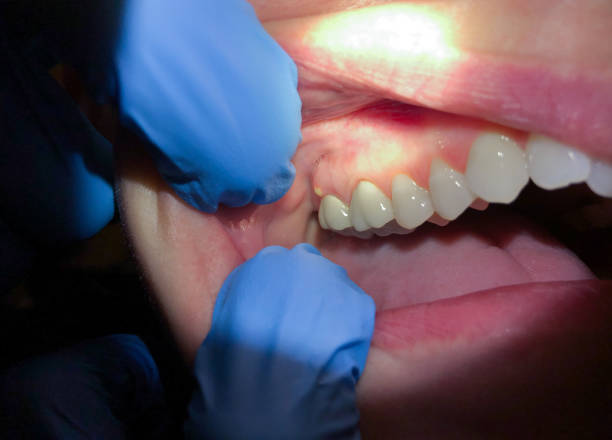 Fast & Reliable Emergency Dental Services in WY