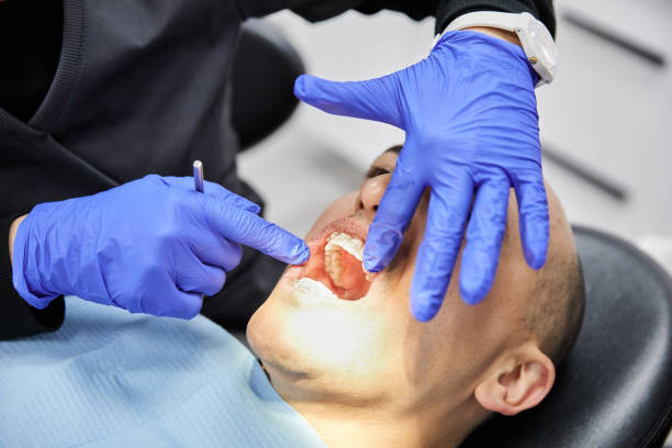 Best Emergency Root Canal Treatment in Arapahoe, WY