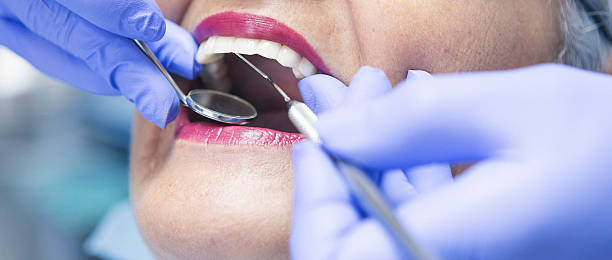 Best Emergency Dental Extractions in Arapahoe, WY